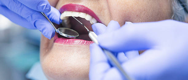 Best Emergency Treatment for Toothache in Carbondale, KS