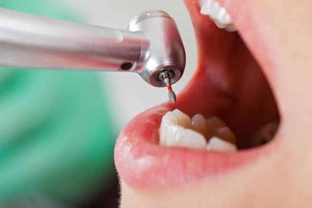 Best Emergency Treatment for Toothache in Carbondale, KS